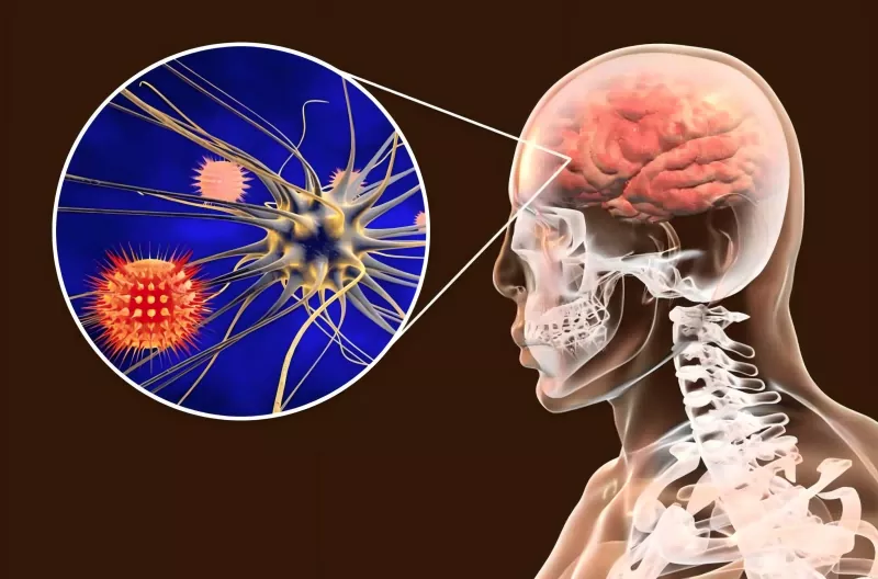 Meningococcal Vaccine